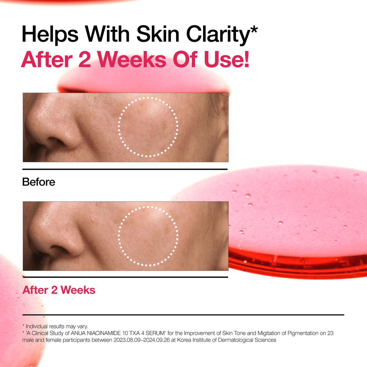 Niacinamide 10 % + TXA 4 % Serum
