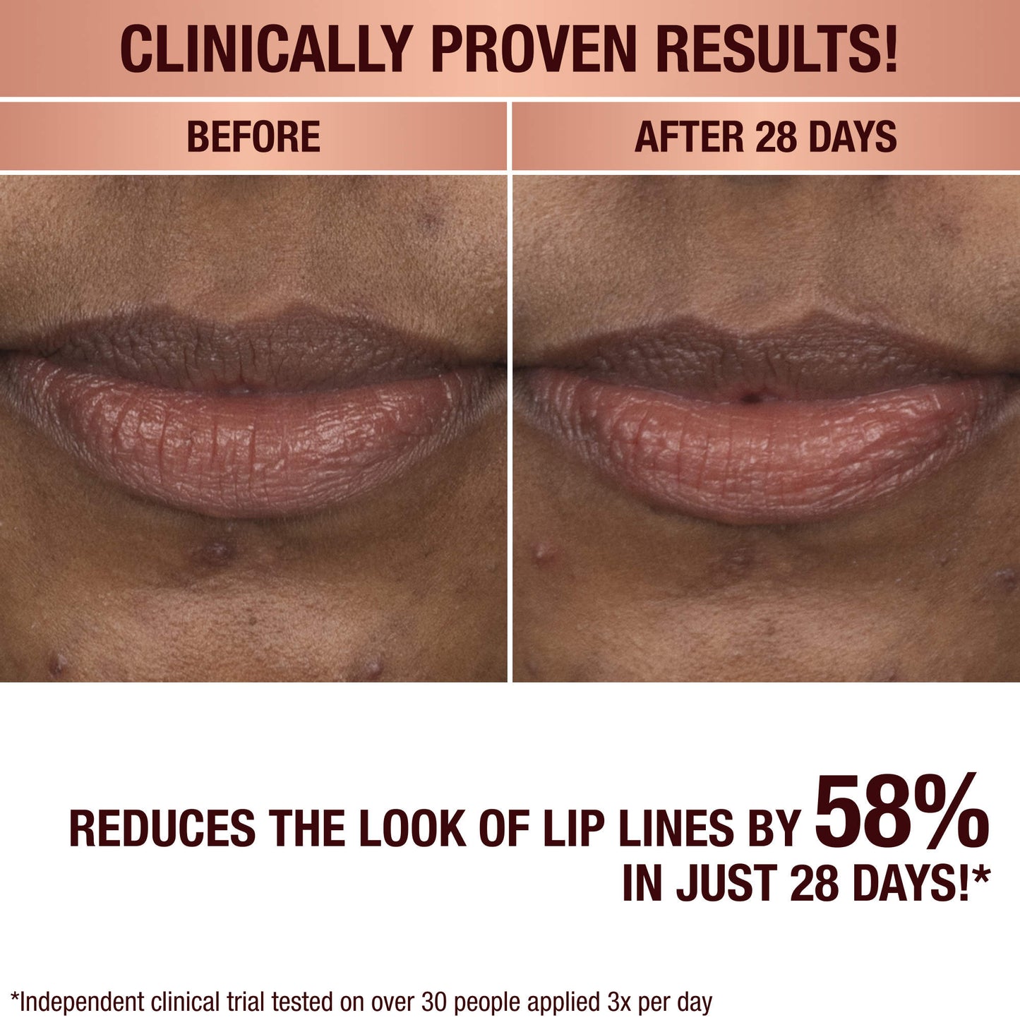 Charlotte Tilbury – Life Changing Lip Mask with Cushioning Ceramides