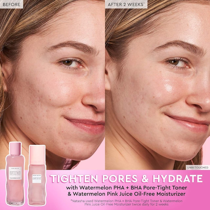 Glow Recipe Watermelon Glow PHA + BHA Pore-Tight Toner