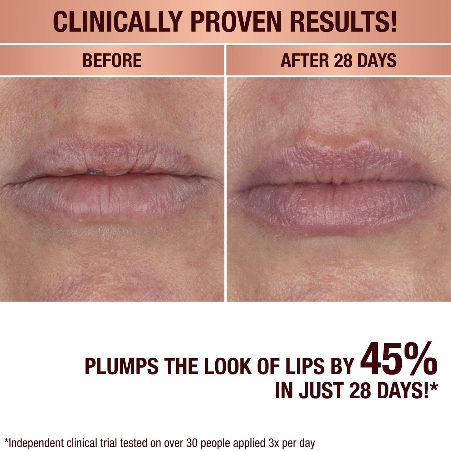 Charlotte Tilbury – Life Changing Lip Mask with Cushioning Ceramides